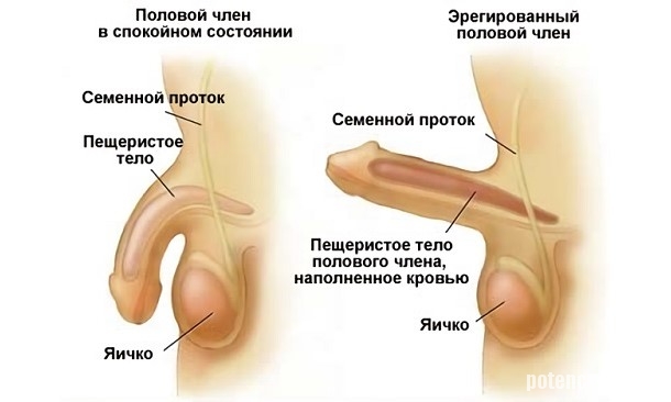Импотенция